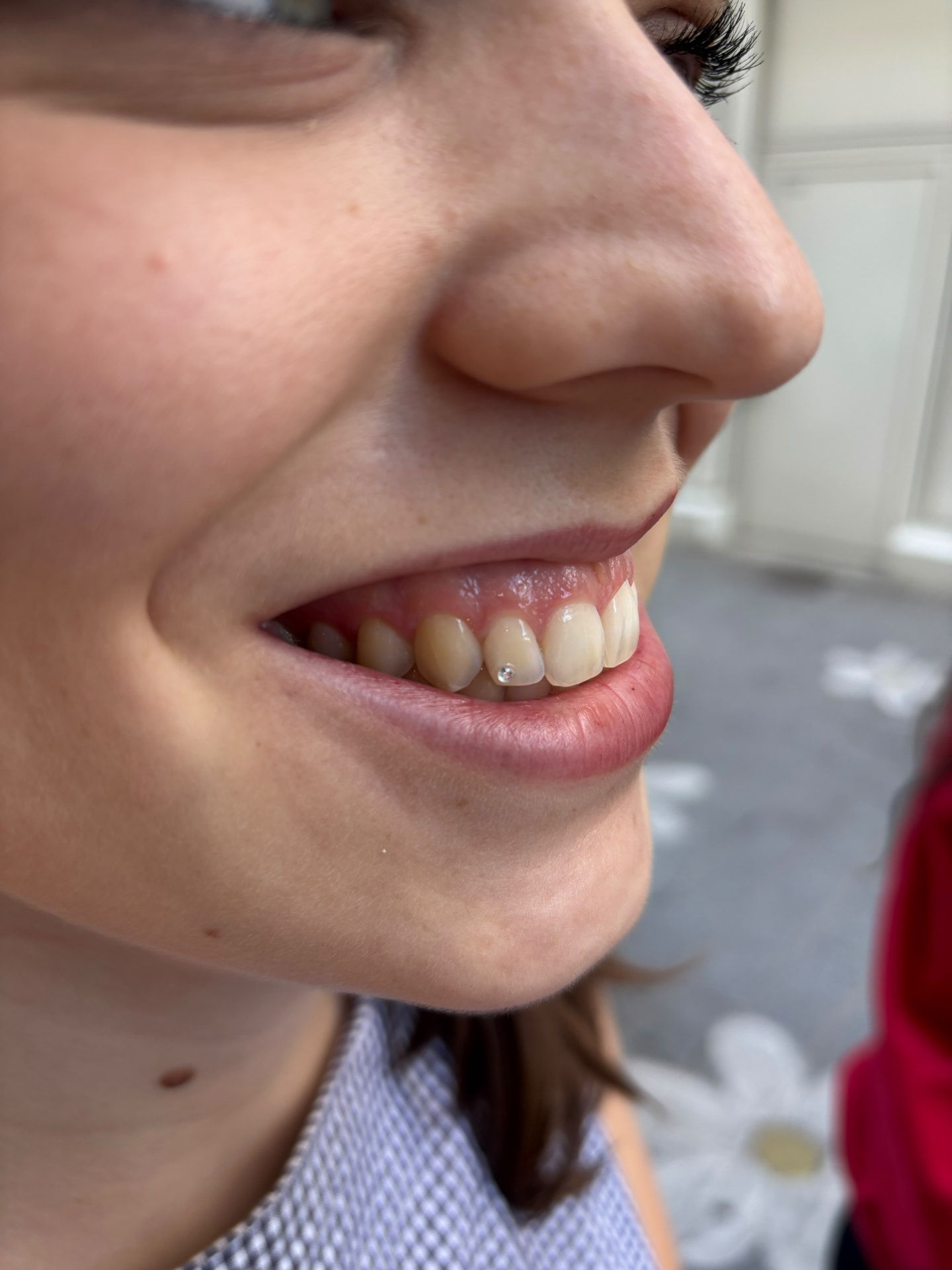 Strass dentaire discret sur un sourire — Casa de Leões Nantes
